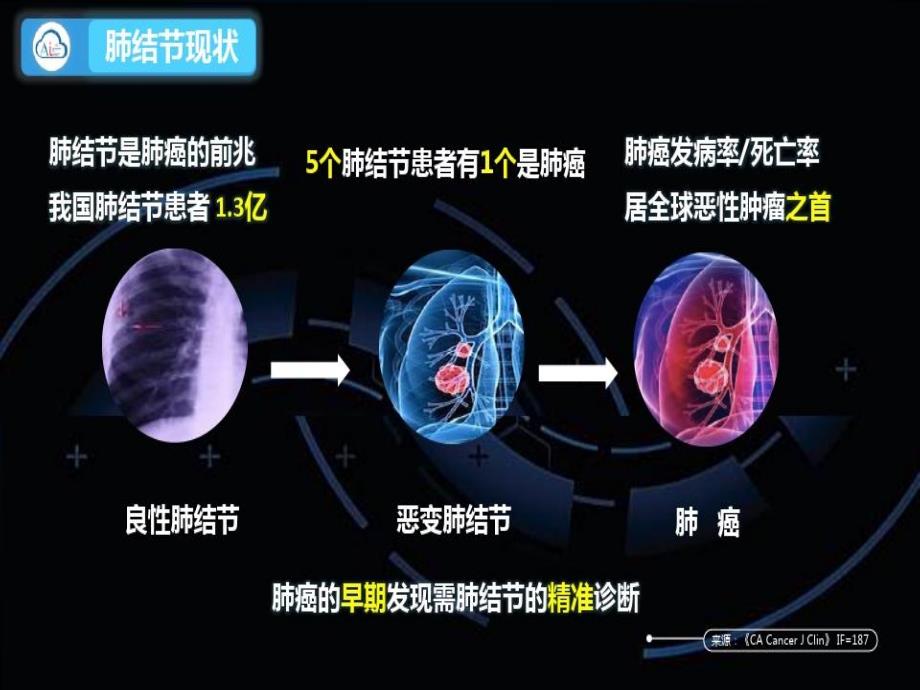 肺结节人工智能28页PPT课件_第3页