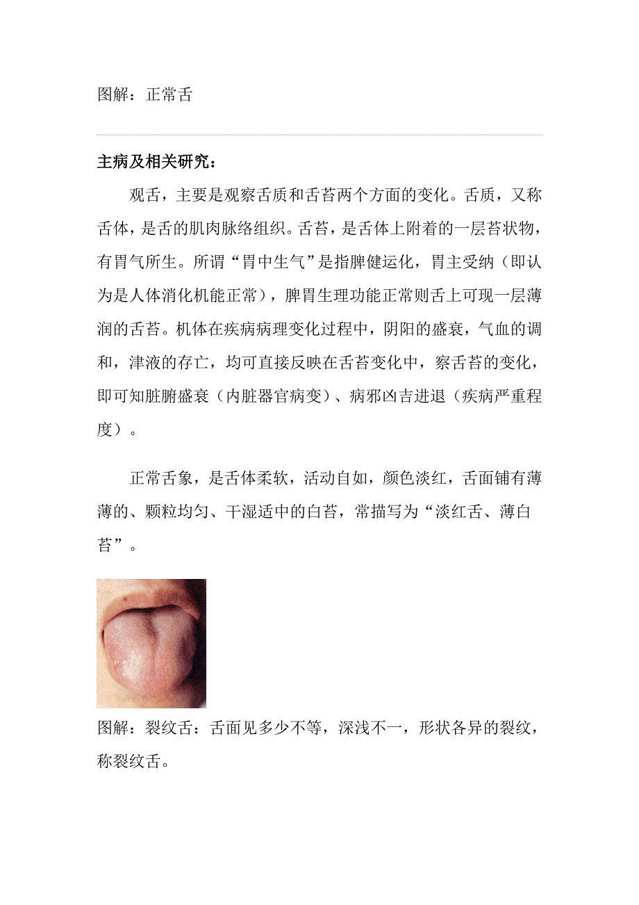 舌头病例种类.doc_第1页