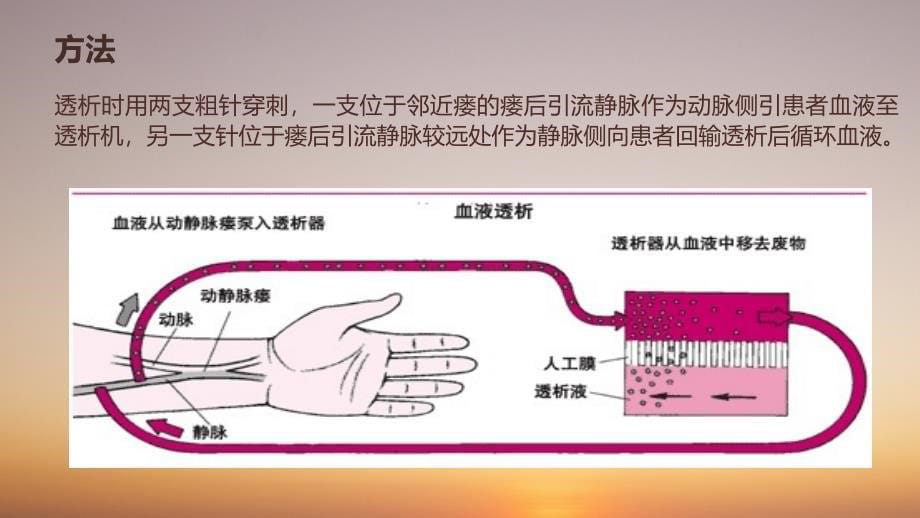 动静脉内瘘的超声检查.ppt_第5页