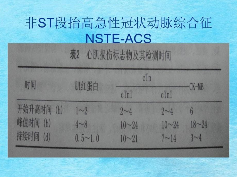 急性冠脉综合症的治疗ppt课件_第5页