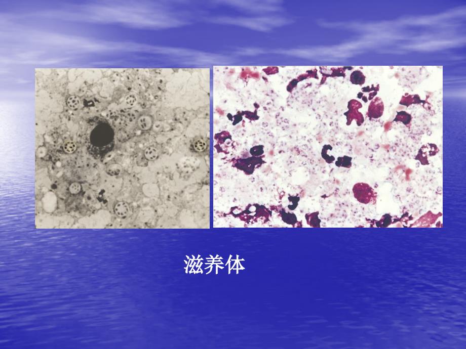 卡氏肺孢子虫Pneumocystis_第4页