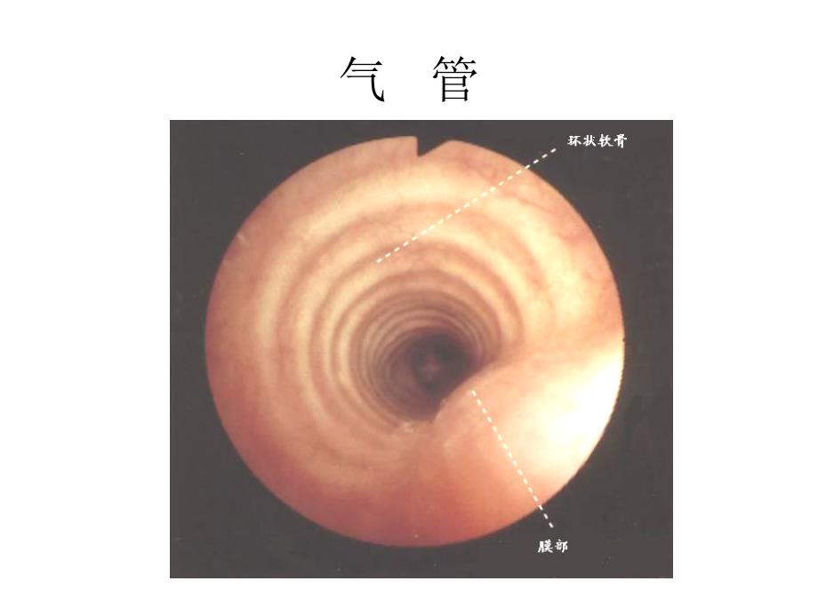 支气管镜精美图谱_第4页