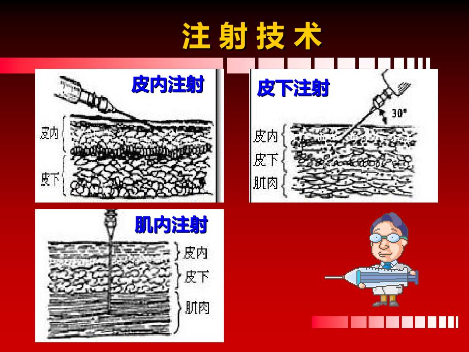 各种注射法ppt课件_第3页