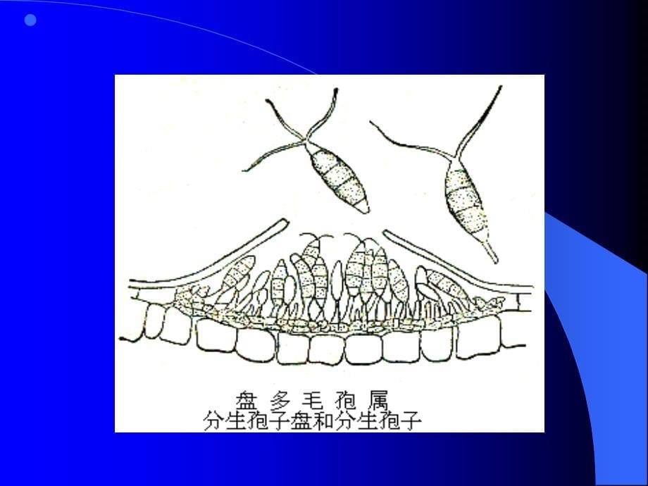 苗木猝倒和立枯课件_第5页