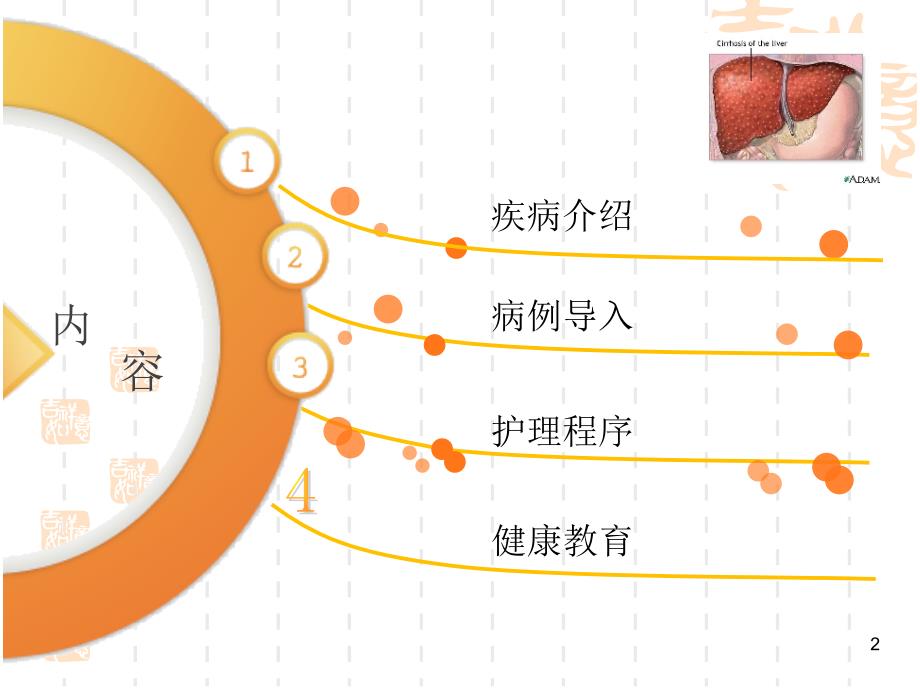 肝硬化病人的护理查房课件_第2页