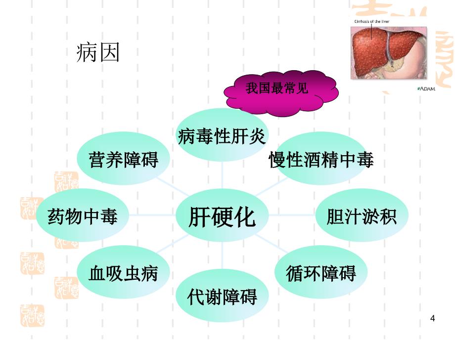 肝硬化病人的护理查房课件_第4页