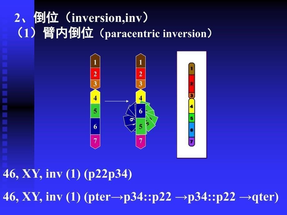 染色体疾病的诊断二.ppt_第5页