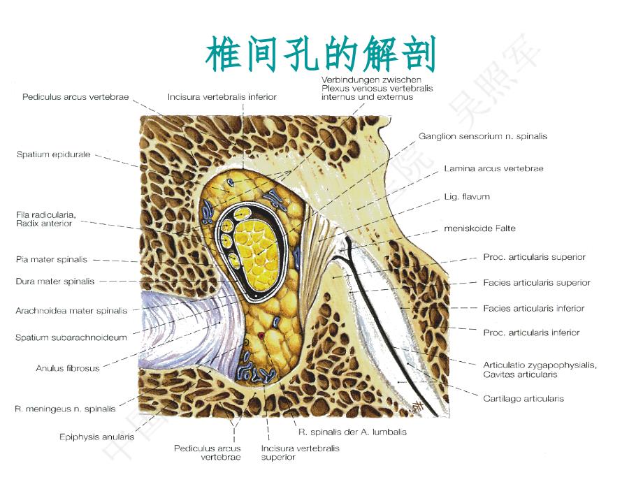 吴主任椎间孔镜ppt课件_第3页