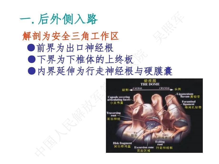 吴主任椎间孔镜ppt课件_第5页