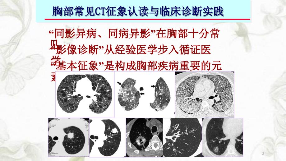 胸部常见CT十大征象的诊断及应用课件_第2页