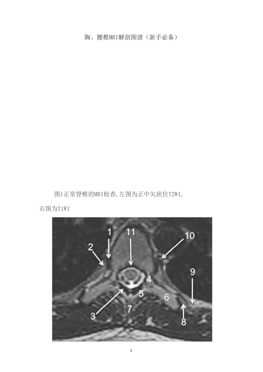 胸、腰椎MRI解剖图谱(新手必备)_第1页
