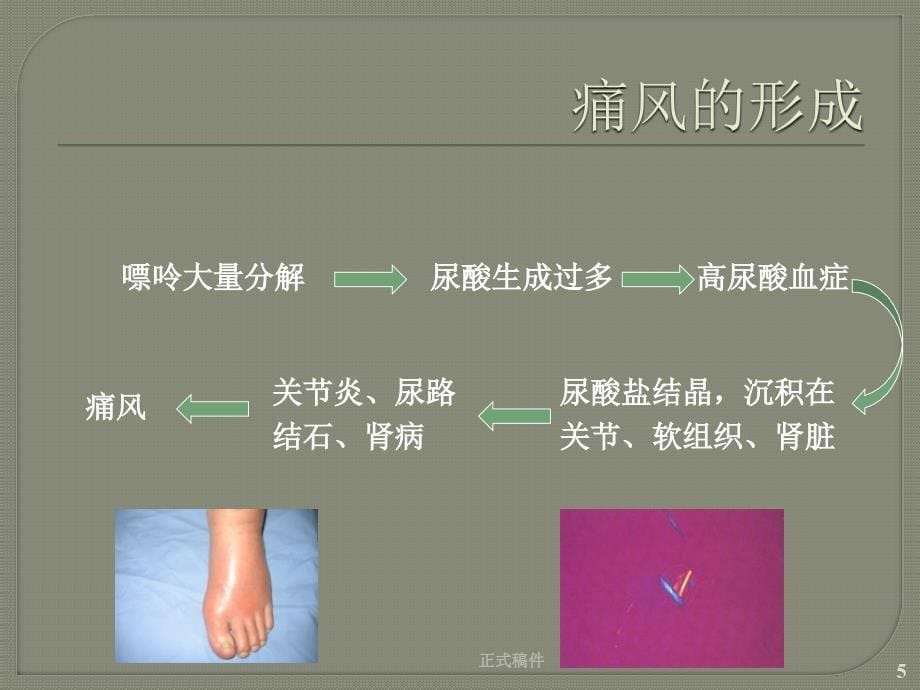 痛风的详细诊疗专业技术_第5页