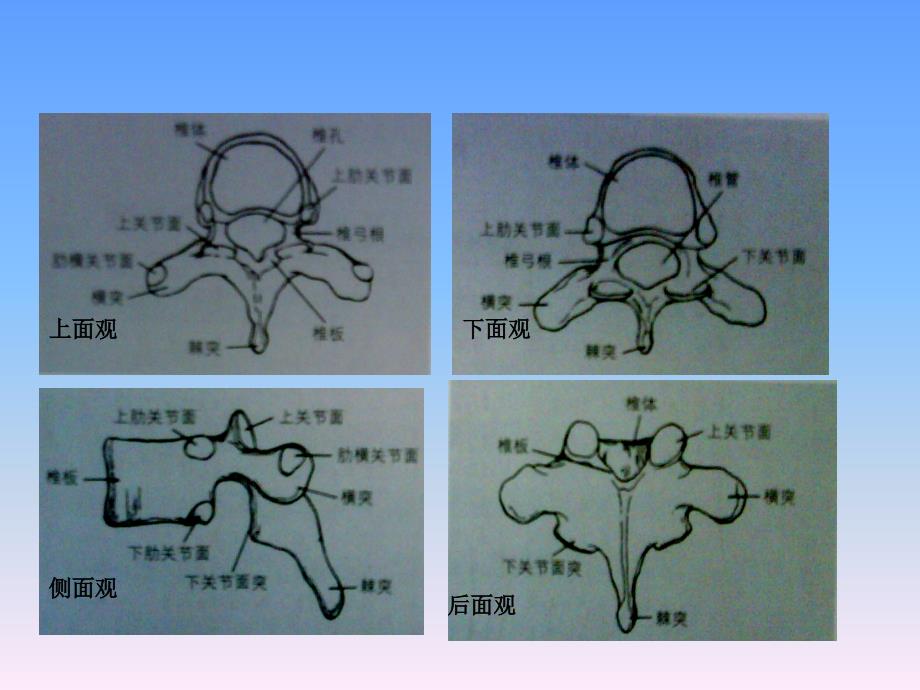 胸椎椎弓根解剖与临床_第3页