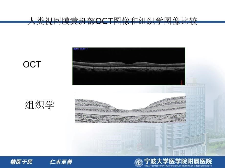 光学相干断层成像技术OCT的临床应用.ppt_第5页