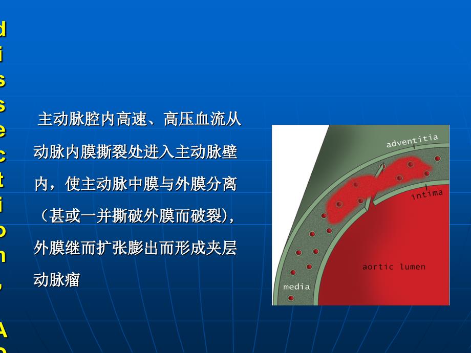 主动脉综合征的诊治_第4页