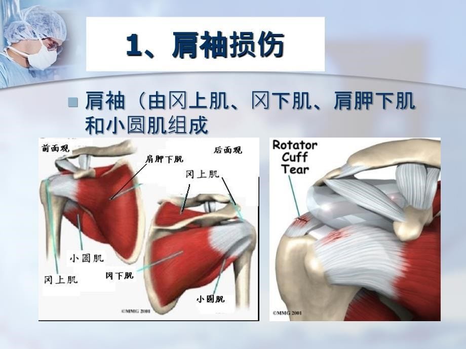 外伤史以跌倒手掌撑地最多见_第5页