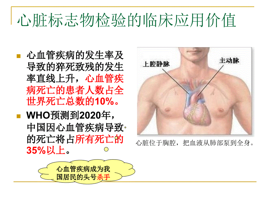 最新心脏标志物的临床应用39PPT课件_第2页