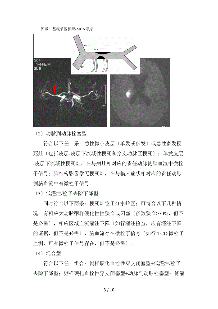 脑梗死的分型诊断和分层治疗_第3页