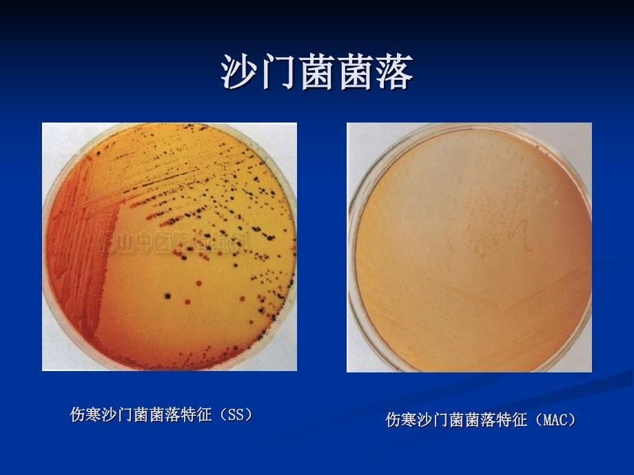 肠杆菌科沙门菌属_第5页