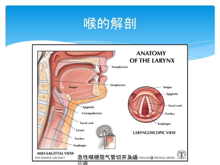 急性喉梗阻气管切开及适应症培训课件_第2页