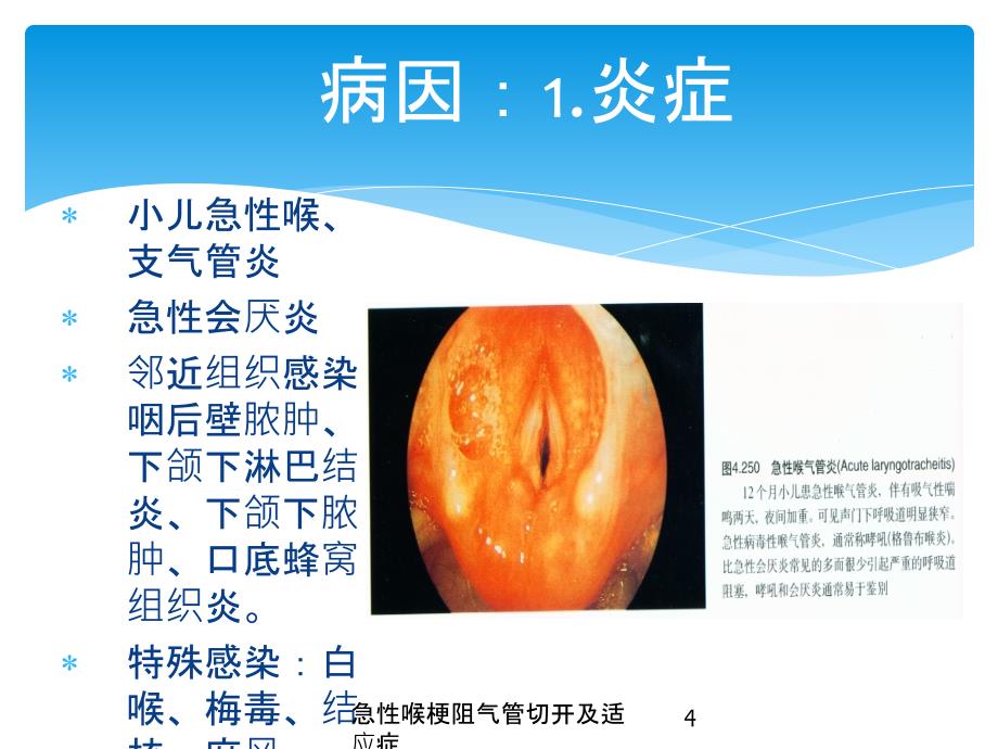 急性喉梗阻气管切开及适应症培训课件_第4页