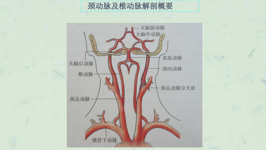 颈动脉疾病超声诊断医学课件_第2页