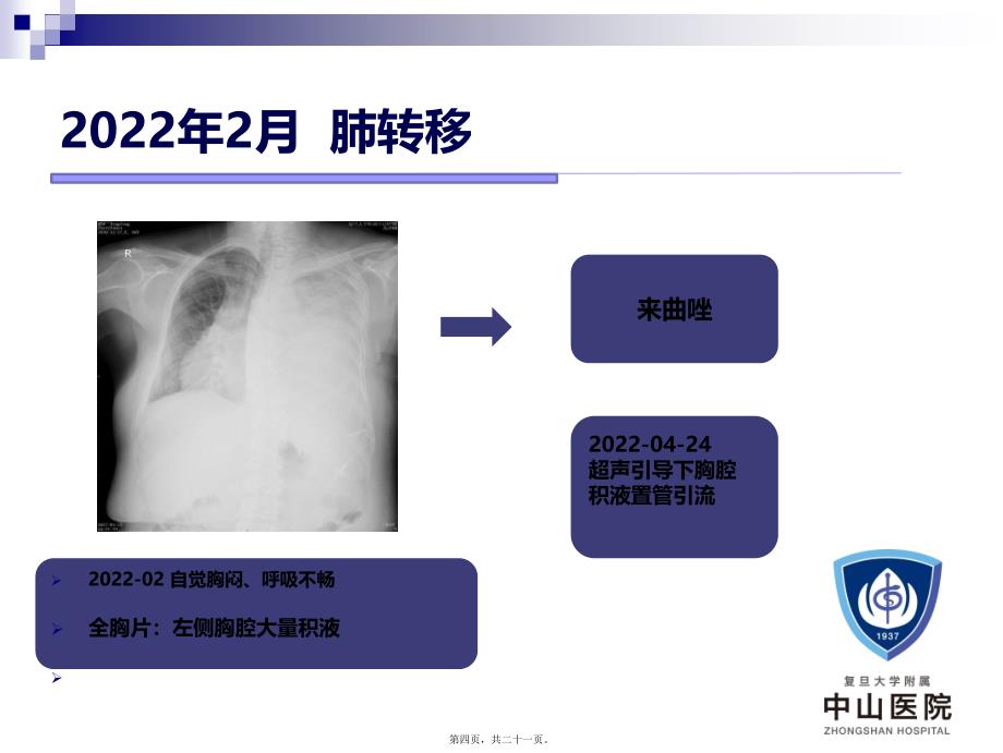 乳腺癌病例分享_第4页