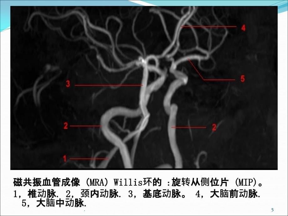 头颈部动脉解剖PPT课件_第5页