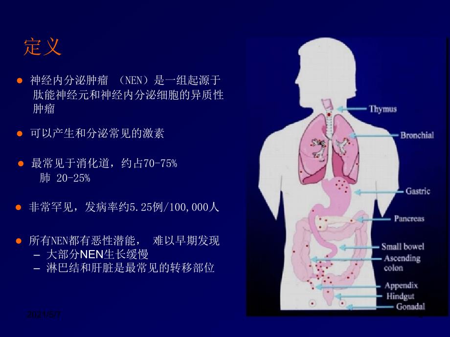 神经内分泌肿瘤_第2页