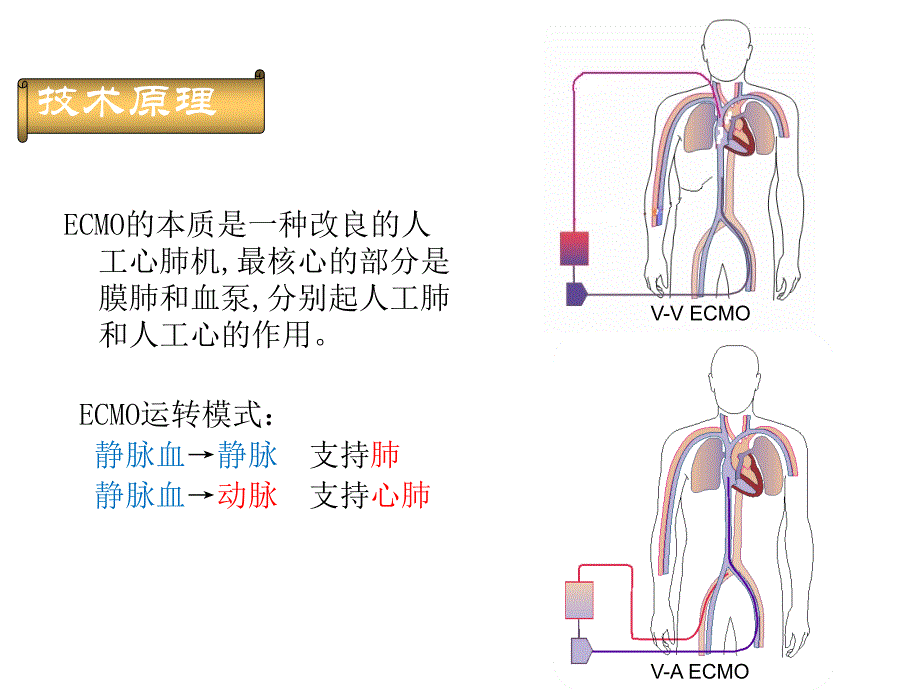 ECMO治疗危重患者进展_第2页