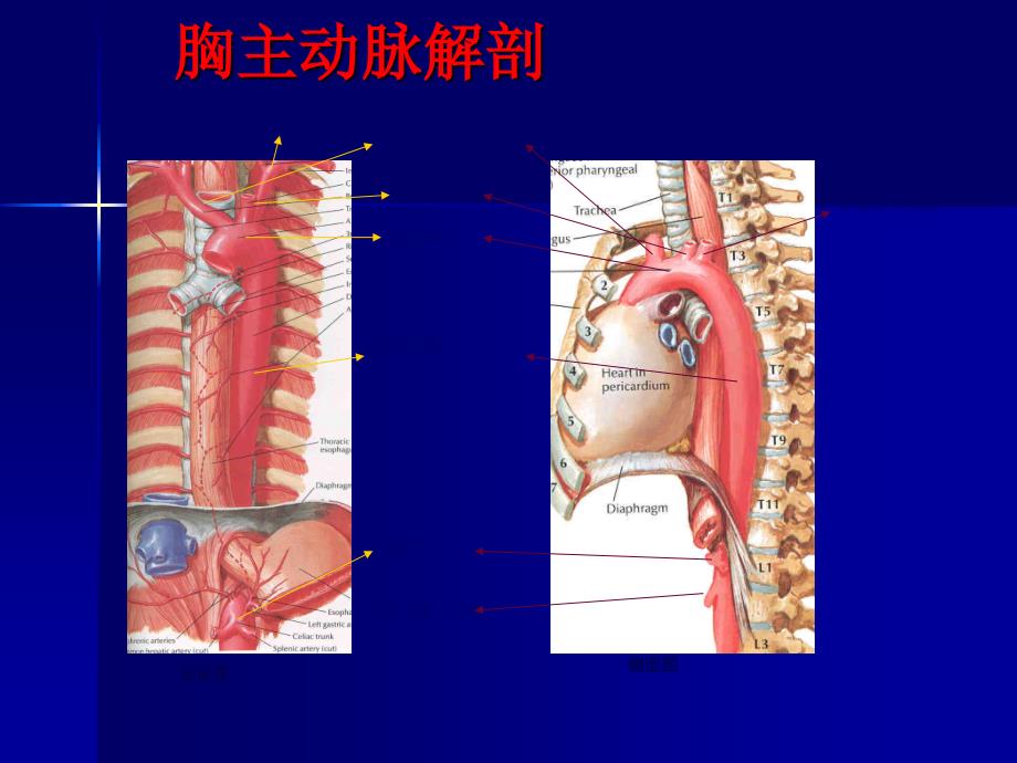 主动脉夹层及腹主动瘤CTA影像学课件_第2页