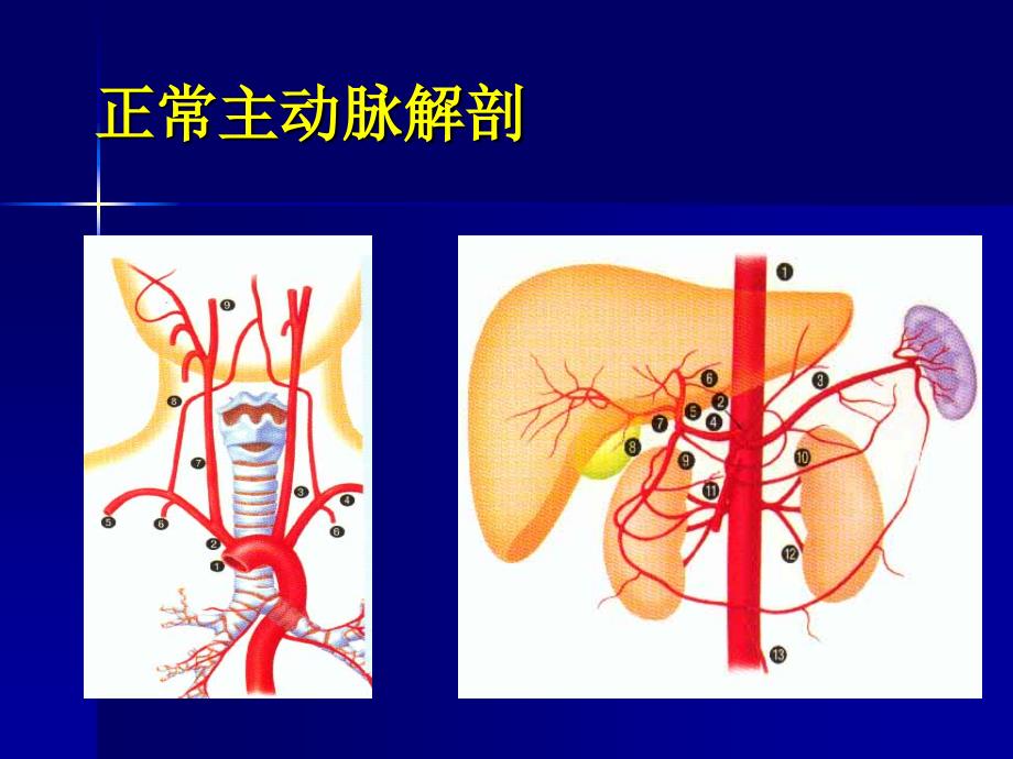 主动脉夹层及腹主动瘤CTA影像学课件_第3页