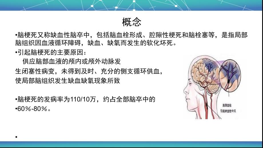 脑梗死的业务学习_第2页