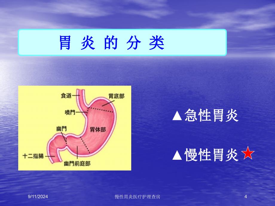 慢性胃炎医疗护理查房培训课件_第4页