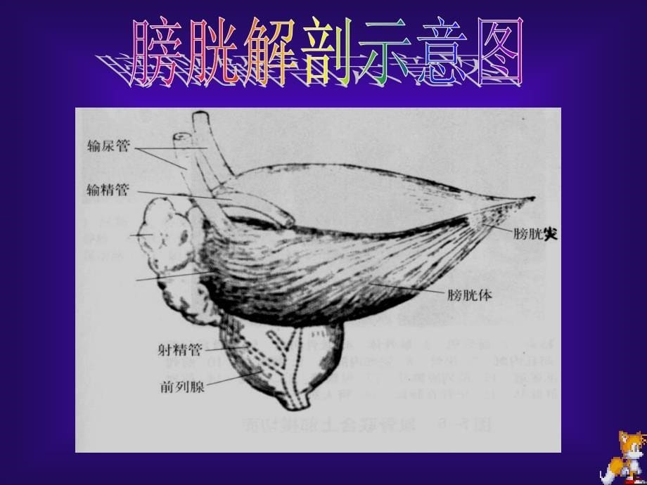 膀胱肿瘤的超声诊断及鉴别诊断_第5页