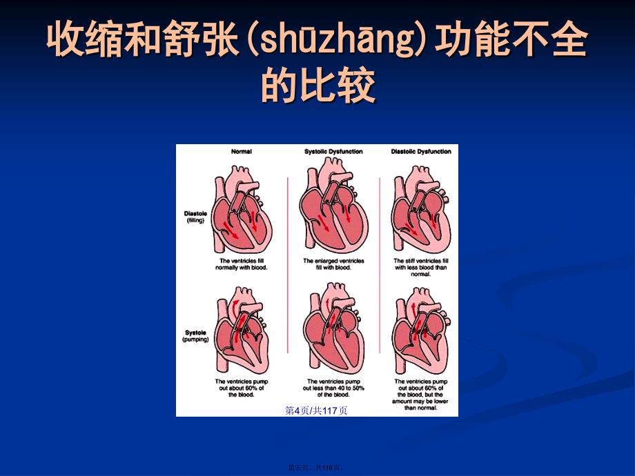 内科学心力衰竭八学习教案_第5页