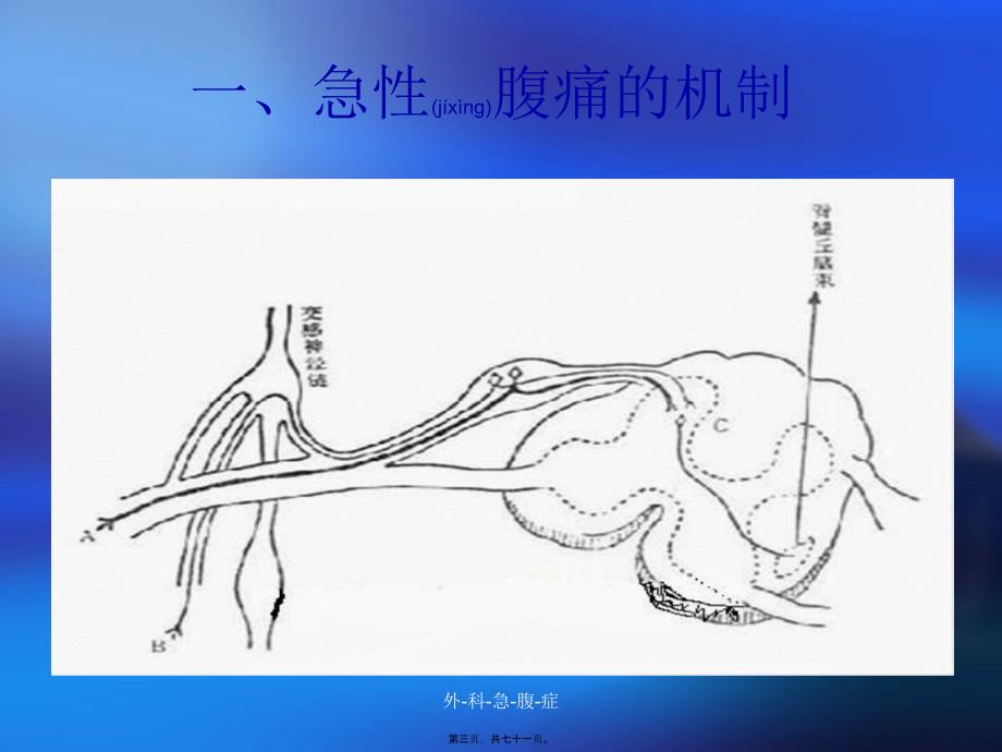 外-科-急-腹-症课件_第3页