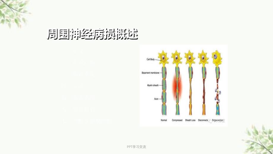 常见神经疾病的评定技术课件_第4页