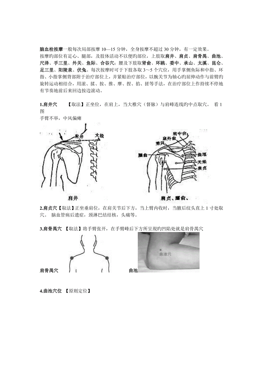 治疗中风的穴位_第1页