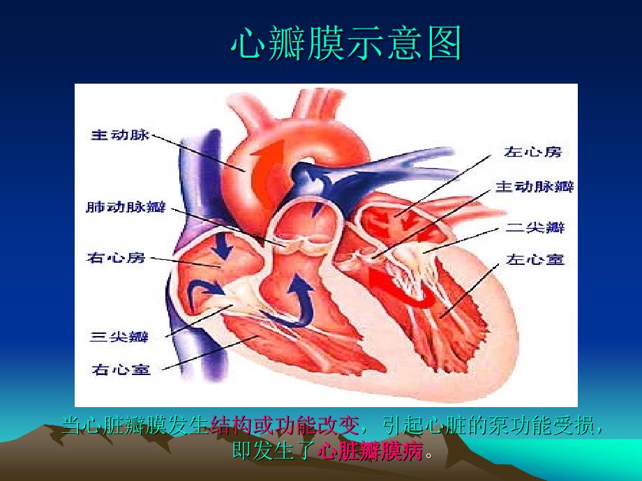 二尖瓣膜狭窄与换瓣治疗_第2页