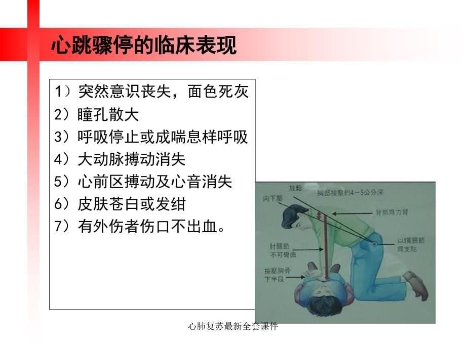 心肺复苏最新全套课件_第5页