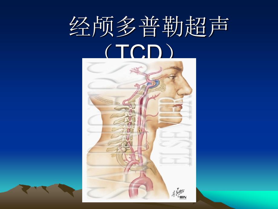 《经颅多普勒超声》PPT课件.ppt_第1页