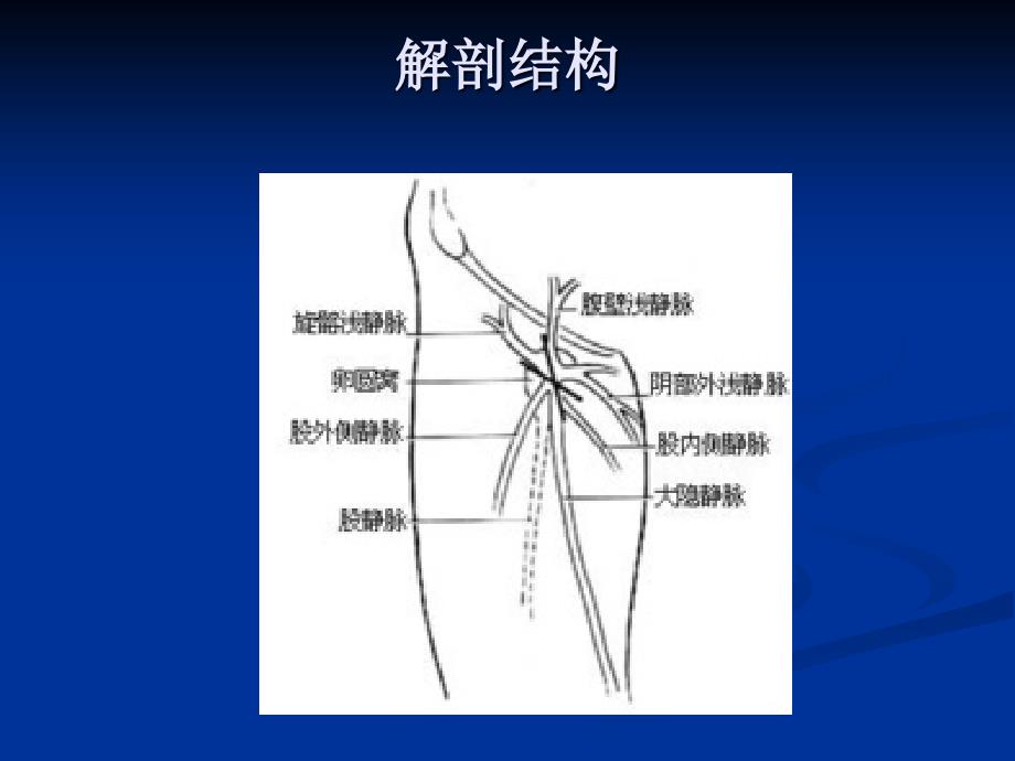 大隐静脉曲张_第4页