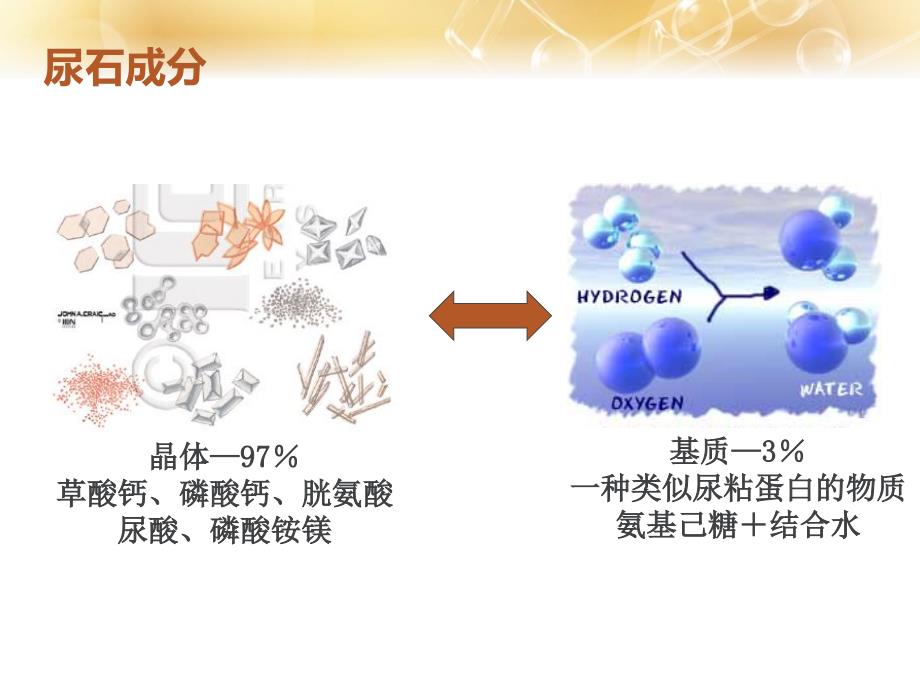 泌尿系结石课件_第3页