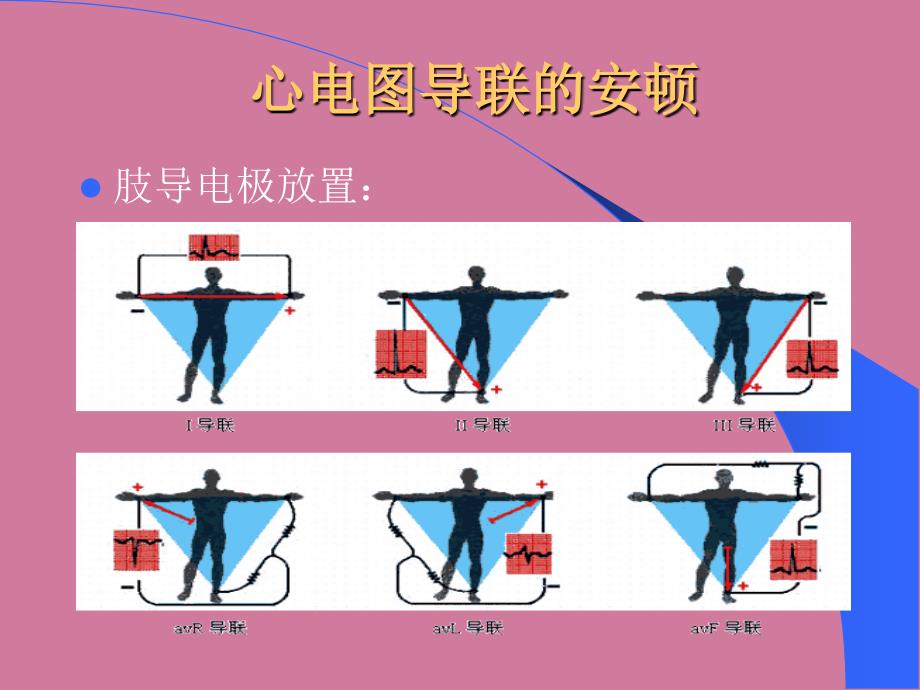 心电图浅析ppt课件_第3页