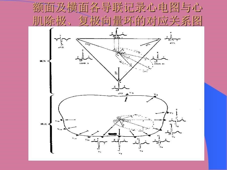 心电图浅析ppt课件_第5页