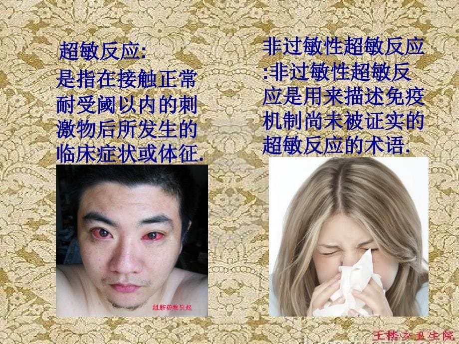 《过敏知识讲座》PPT课件.ppt_第5页