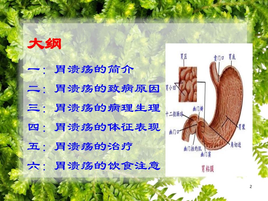 胃溃疡的形成机制及治疗ppt课件_第2页