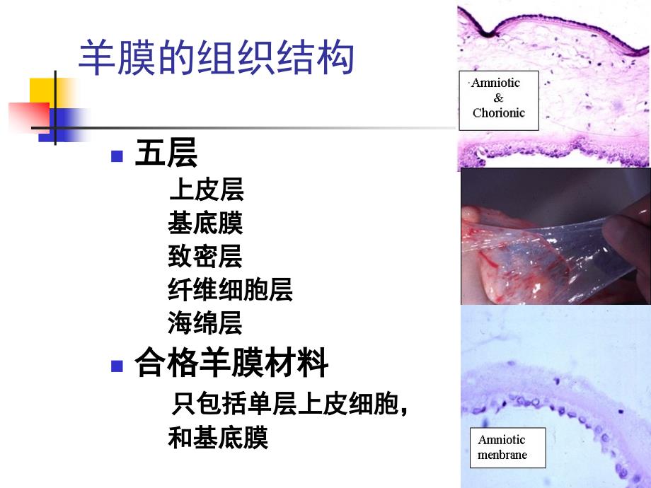 羊膜在眼科的应用.ppt_第3页