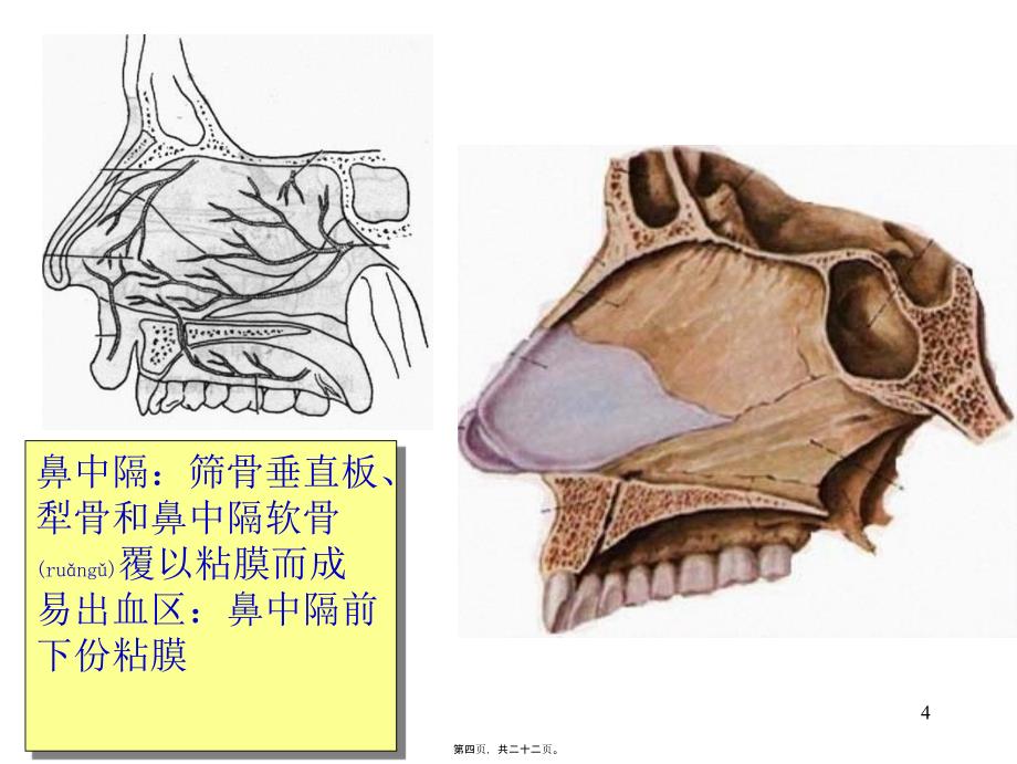 医学专题—呼吸系统-肺外呼吸道12427_第4页